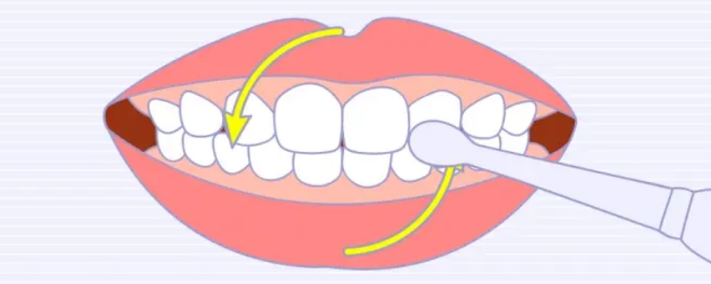 圆弧刷牙法（圆弧刷牙法步骤）