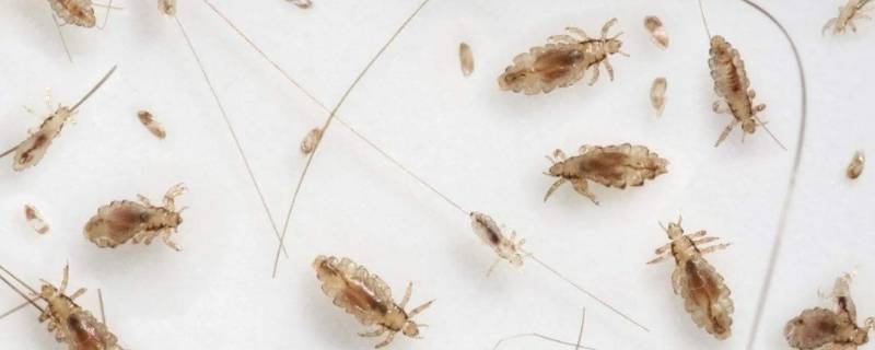 虱子蛋长什么样 虱子长什么样子