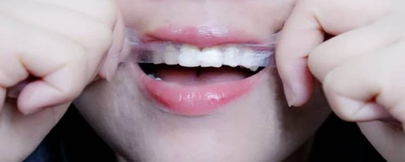 牙贴是刷牙前用还是刷牙后用 美白牙贴是刷牙前用还是刷牙后用