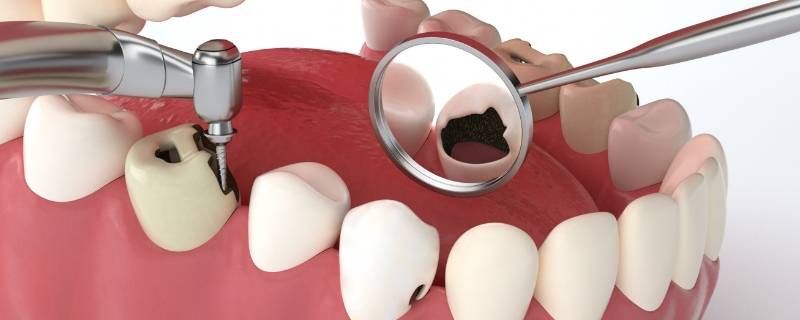 缺巴子是什么意思 武汉话缺巴子是什么意思