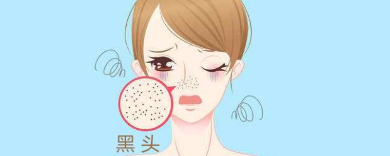 黑头怎么去除的简单方法 黑头 怎么去除