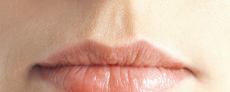 嘴上疱疹有脓要挤掉吗（唇疱疹要把脓挤出来吗）
