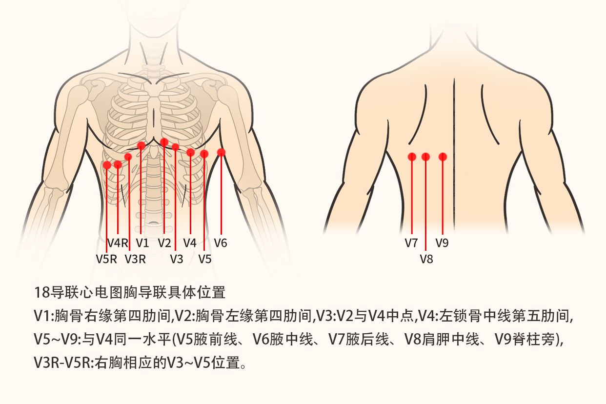 18导心电图连接示意图 18导心电图连接示意图 视频教程