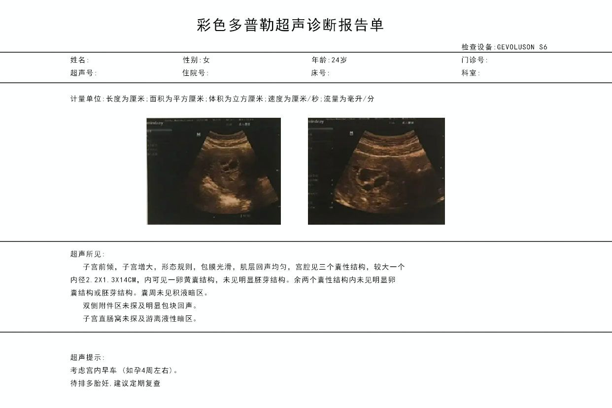 怀孕4周的彩超图片（怀孕4周的B超图片）