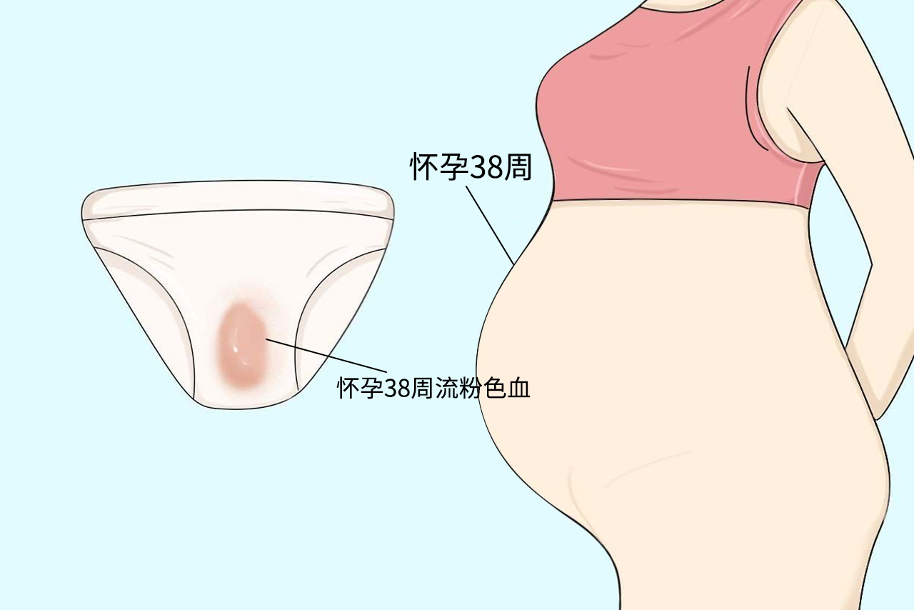 孕38周粉色分泌物图片（孕38周分泌物增多有点粉色）