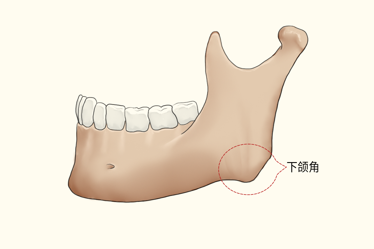 标准的下颌角图片
