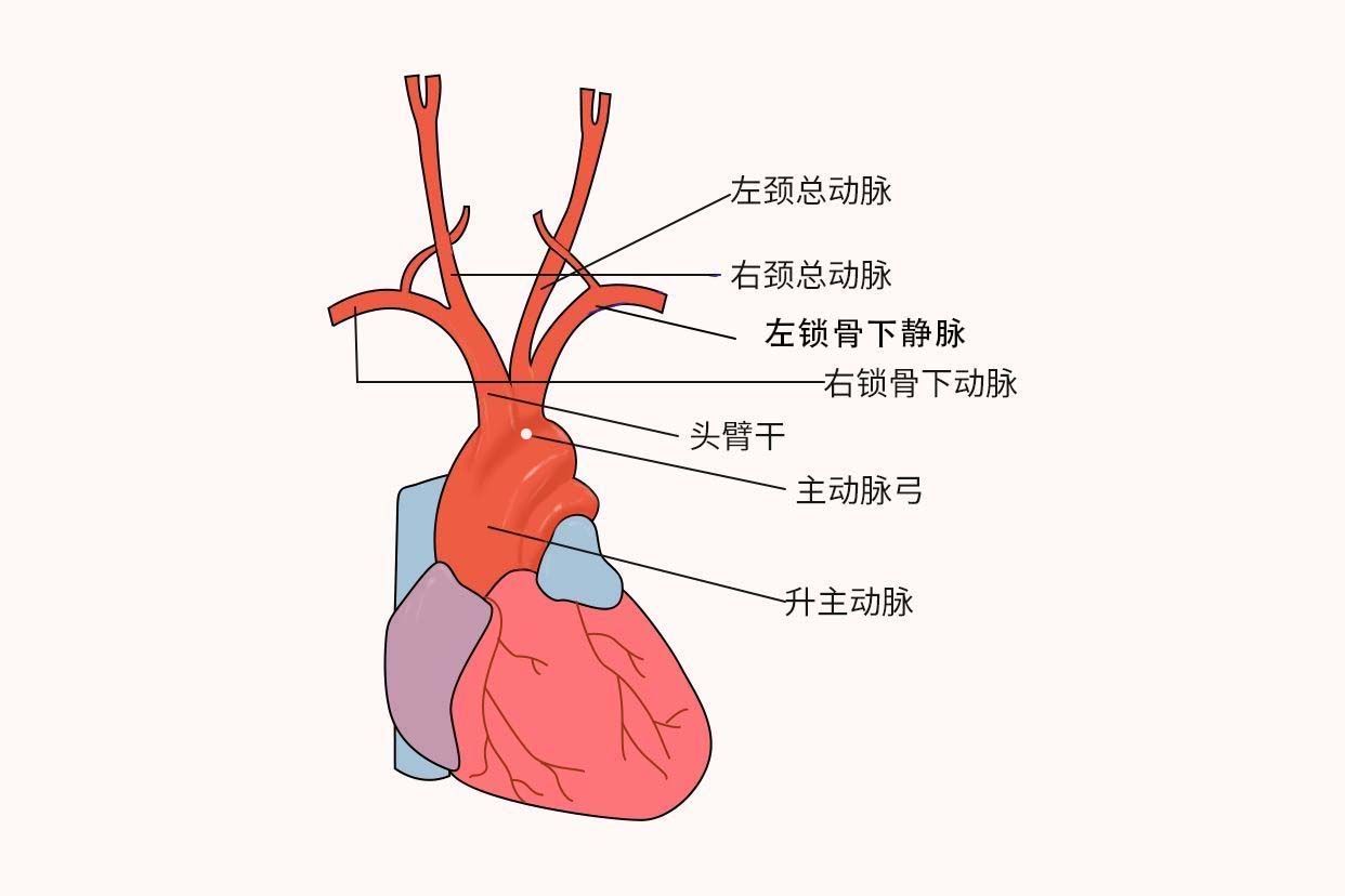 主动脉弓位置示意图