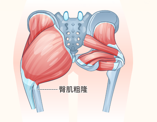 臀肌粗隆在哪个位置图片