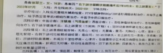 7年的口腔鳞状细胞癌患者，临床治疗全过程分析