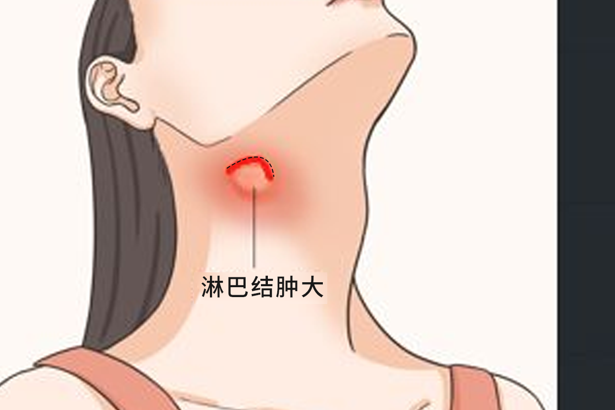 颈部淋巴手术切口图片 颈部淋巴手术切口图片大全