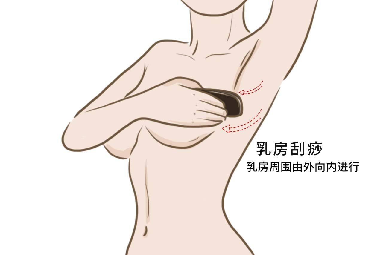 乳房刮痧图解 乳房刮痧图解视频