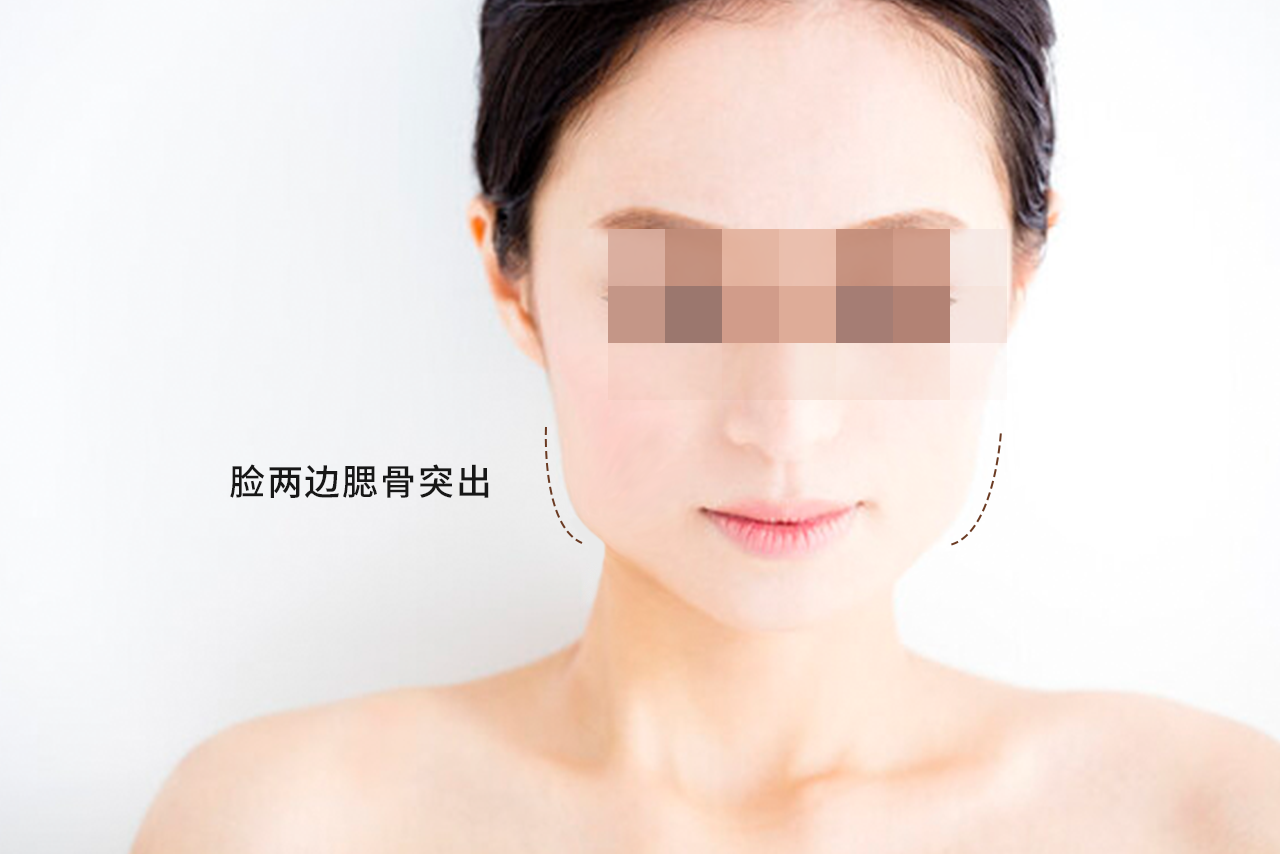 女人脸两边腮骨突出图片 女人脸两边腮骨突出图片大全