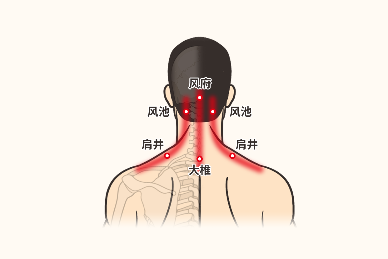 感冒头痛刮痧刮什么部位图 刮痧治感冒的部位图解