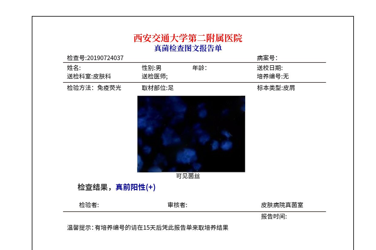 真菌检查报告单图片（真菌检查报告单图片高清）