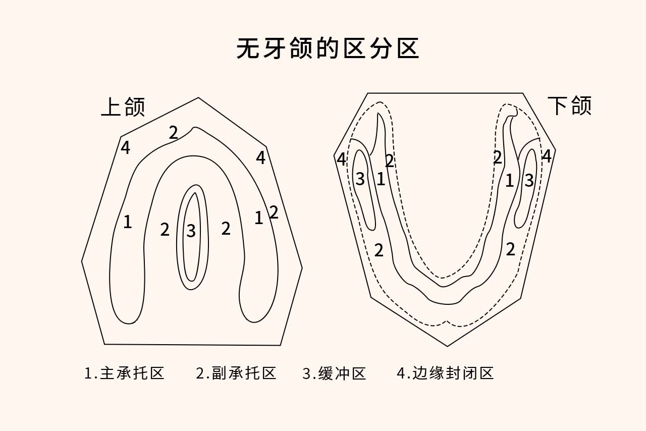 全口义齿无牙颌分区图 全口义齿无牙颌分区图解