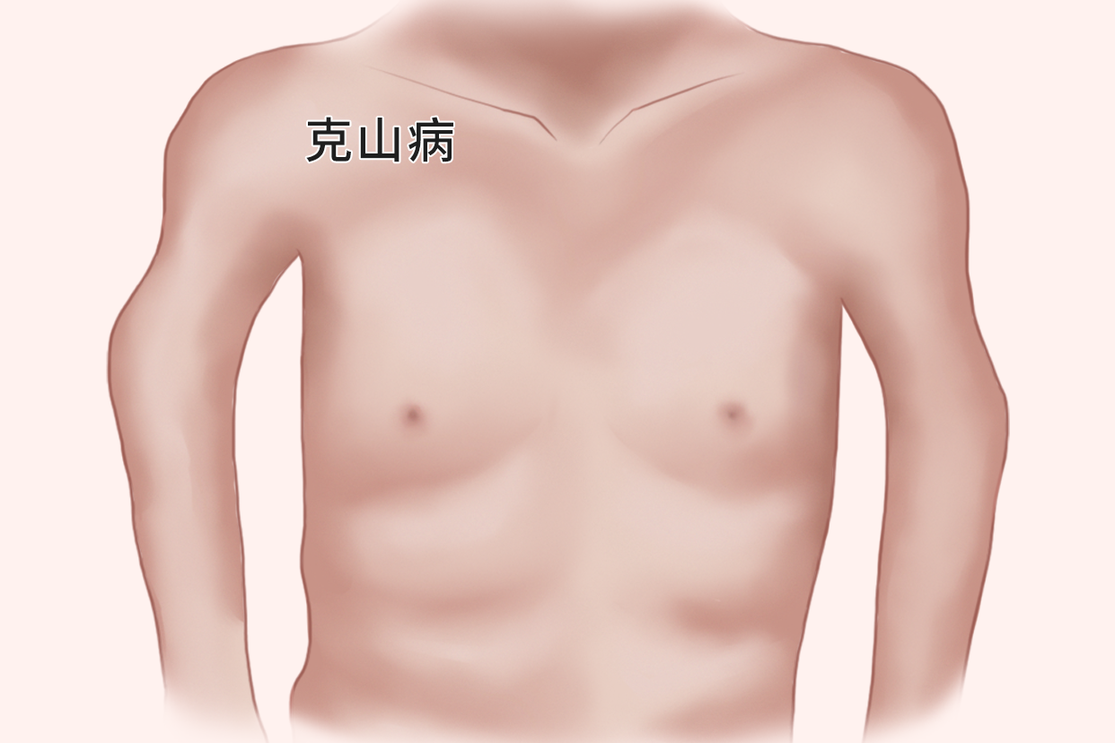 人体缺硒容易得什么病呢图片 人体缺硒容易患什么病