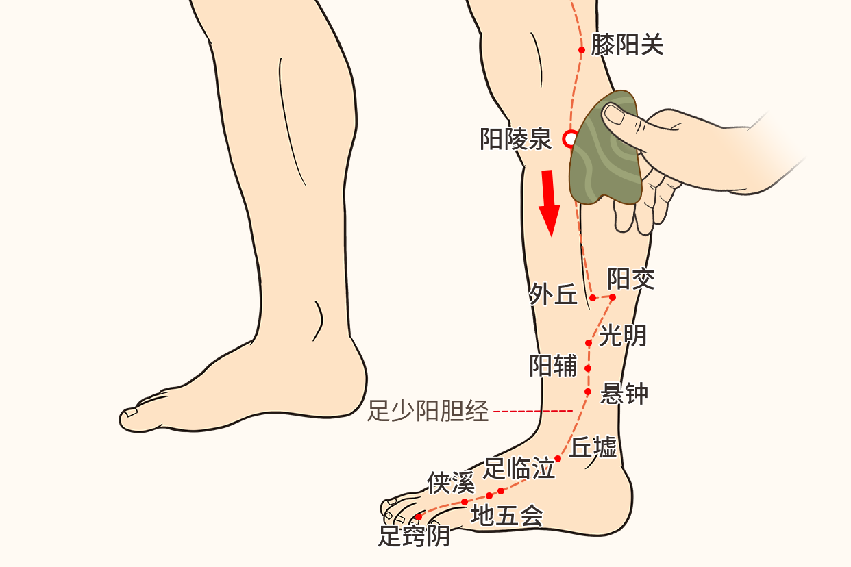 肝胆湿热刮痧示意图 肝胆湿热刮痧的方法