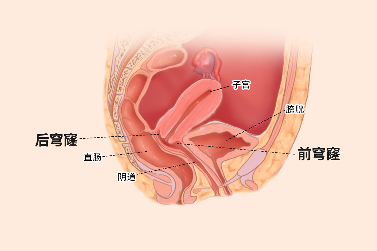 穹隆部位在哪里图片 眼睛穹隆部位在哪里图片