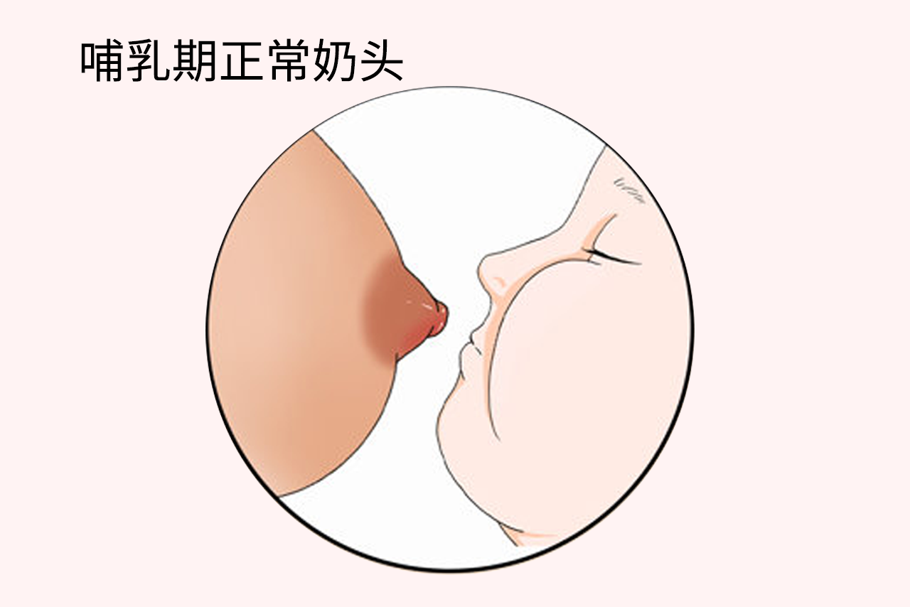 哺乳期正常奶头图 哺乳期正常乳房颜色是什么样的