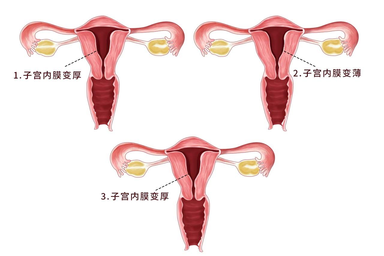 子宫一个月的变化图片 子宫一个月的变化图片大全