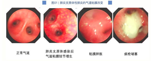 7岁男童肺部实变！有医院一天最高峰67例“洗肺”……