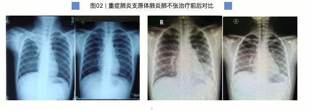 7岁男童肺部实变！有医院一天最高峰67例“洗肺”……