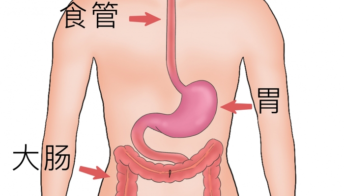 幽门螺杆菌到底要不要治